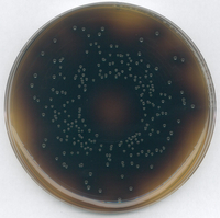 OXFORD LISTERIA SELECTIVE AGAR (BASE) FO